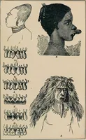 An illustration from Ladies' guide in health and disease : girlhood, maidenhood, wifehood, motherhood / by J.H. Kellogg. (1892)
