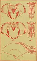 An illustration from Ladies' guide in health and disease : girlhood, maidenhood, wifehood, motherhood / by J.H. Kellogg. (1892)
