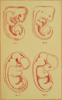An illustration from Ladies' guide in health and disease : girlhood, maidenhood, wifehood, motherhood / by J.H. Kellogg. (1892)