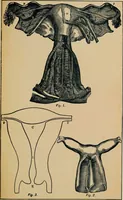 An illustration from Ladies' guide in health and disease : girlhood, maidenhood, wifehood, motherhood / by J.H. Kellogg. (1892)