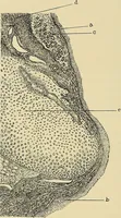 An illustration from Diseases of the nose and throat / by J. Price-Brown ; ill. with 159 engravings, including 6 full-page color-plates and 9 color-cuts in the text, many of them original. (1900)