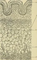 An illustration from Diseases of the nose and throat / by J. Price-Brown ; ill. with 159 engravings, including 6 full-page color-plates and 9 color-cuts in the text, many of them original. (1900)