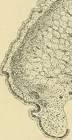 An illustration from Diseases of the nose and throat / by J. Price-Brown ; ill. with 159 engravings, including 6 full-page color-plates and 9 color-cuts in the text, many of them original. (1900)