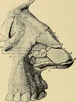 An illustration from Diseases of the nose and throat / by J. Price-Brown ; ill. with 159 engravings, including 6 full-page color-plates and 9 color-cuts in the text, many of them original. (1900)