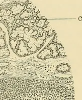 An illustration from Diseases of the nose and throat / by J. Price-Brown ; ill. with 159 engravings, including 6 full-page color-plates and 9 color-cuts in the text, many of them original. (1900)