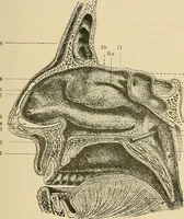 An illustration from Diseases of the nose and throat / by J. Price-Brown ; ill. with 159 engravings, including 6 full-page color-plates and 9 color-cuts in the text, many of them original. (1900)