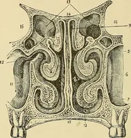 An illustration from Diseases of the nose and throat / by J. Price-Brown ; ill. with 159 engravings, including 6 full-page color-plates and 9 color-cuts in the text, many of them original. (1900)