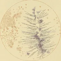 An illustration from Diseases of the nose and throat / by J. Price-Brown ; ill. with 159 engravings, including 6 full-page color-plates and 9 color-cuts in the text, many of them original. (1900)