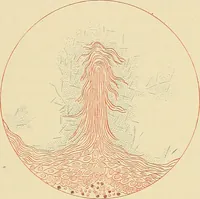 An illustration from Diseases of the nose and throat / by J. Price-Brown ; ill. with 159 engravings, including 6 full-page color-plates and 9 color-cuts in the text, many of them original. (1900)