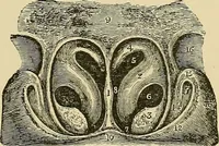 An illustration from Diseases of the nose and throat / by J. Price-Brown ; ill. with 159 engravings, including 6 full-page color-plates and 9 color-cuts in the text, many of them original. (1900)