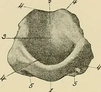 An illustration from Diseases of the nose and throat / by J. Price-Brown ; ill. with 159 engravings, including 6 full-page color-plates and 9 color-cuts in the text, many of them original. (1900)
