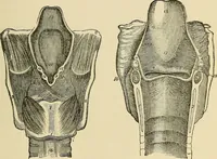 An illustration from Diseases of the nose and throat / by J. Price-Brown ; ill. with 159 engravings, including 6 full-page color-plates and 9 color-cuts in the text, many of them original. (1900)