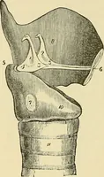 An illustration from Diseases of the nose and throat / by J. Price-Brown ; ill. with 159 engravings, including 6 full-page color-plates and 9 color-cuts in the text, many of them original. (1900)