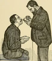 An illustration from Diseases of the nose and throat / by J. Price-Brown ; ill. with 159 engravings, including 6 full-page color-plates and 9 color-cuts in the text, many of them original. (1900)