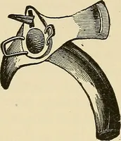 An illustration from Diseases of the nose and throat / by J. Price-Brown ; ill. with 159 engravings, including 6 full-page color-plates and 9 color-cuts in the text, many of them original. (1900)
