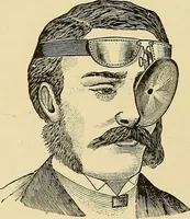 An illustration from Diseases of the nose and throat / by J. Price-Brown ; ill. with 159 engravings, including 6 full-page color-plates and 9 color-cuts in the text, many of them original. (1900)
