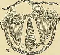 An illustration from Diseases of the nose and throat / by J. Price-Brown ; ill. with 159 engravings, including 6 full-page color-plates and 9 color-cuts in the text, many of them original. (1900)