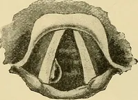An illustration from Diseases of the nose and throat / by J. Price-Brown ; ill. with 159 engravings, including 6 full-page color-plates and 9 color-cuts in the text, many of them original. (1900)