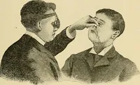 An illustration from Diseases of the nose and throat / by J. Price-Brown ; ill. with 159 engravings, including 6 full-page color-plates and 9 color-cuts in the text, many of them original. (1900)