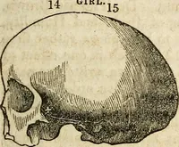 An illustration from Elements of phrenology / By George Combe. From the fifth Edinburgh improved and enlarged edition. With illustrations. (1846)