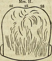 An illustration from Elements of phrenology / By George Combe. From the fifth Edinburgh improved and enlarged edition. With illustrations. (1846)