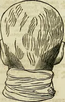 An illustration from Elements of phrenology / By George Combe. From the fifth Edinburgh improved and enlarged edition. With illustrations. (1846)