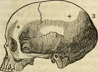 An illustration from Elements of phrenology / By George Combe. From the fifth Edinburgh improved and enlarged edition. With illustrations. (1846)