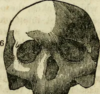 An illustration from Elements of phrenology / By George Combe. From the fifth Edinburgh improved and enlarged edition. With illustrations. (1846)