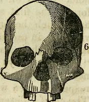 An illustration from Elements of phrenology / By George Combe. From the fifth Edinburgh improved and enlarged edition. With illustrations. (1846)