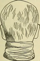 An illustration from Lectures on phrenology / By George Combe, Esq. With notes, an introductory essay, and a historical sketch by Andrew Boardman, M.D. (1895)