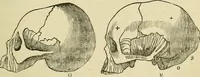 An illustration from Lectures on phrenology / By George Combe, Esq. With notes, an introductory essay, and a historical sketch by Andrew Boardman, M.D. (1895)