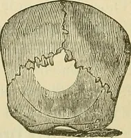 Picture 12 of 30 from Lectures on phrenology / By George Combe, Esq. With notes, an introductory essay, and a historical sketch by Andrew Boardman, M.D. (1895), leaf 155