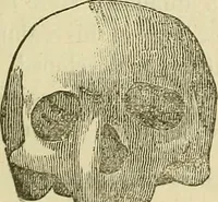 An illustration from Lectures on phrenology / By George Combe, Esq. With notes, an introductory essay, and a historical sketch by Andrew Boardman, M.D. (1895)