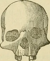 An illustration from Lectures on phrenology / By George Combe, Esq. With notes, an introductory essay, and a historical sketch by Andrew Boardman, M.D. (1895)