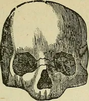 An illustration from Lectures on phrenology / By George Combe, Esq. With notes, an introductory essay, and a historical sketch by Andrew Boardman, M.D. (1895)