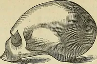 An illustration from Lectures on phrenology / By George Combe, Esq. With notes, an introductory essay, and a historical sketch by Andrew Boardman, M.D. (1895)