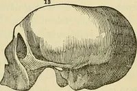 An illustration from Lectures on phrenology / By George Combe, Esq. With notes, an introductory essay, and a historical sketch by Andrew Boardman, M.D. (1895)