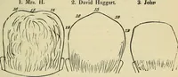 Picture 21 of 30 from Lectures on phrenology / By George Combe, Esq. With notes, an introductory essay, and a historical sketch by Andrew Boardman, M.D. (1895), leaf 207