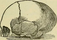 An illustration from Lectures on phrenology / By George Combe, Esq. With notes, an introductory essay, and a historical sketch by Andrew Boardman, M.D. (1895)