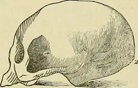 An illustration from Lectures on phrenology / By George Combe, Esq. With notes, an introductory essay, and a historical sketch by Andrew Boardman, M.D. (1895)
