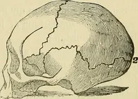An illustration from Lectures on phrenology / By George Combe, Esq. With notes, an introductory essay, and a historical sketch by Andrew Boardman, M.D. (1895)