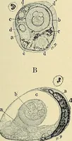 An illustration from Cancer of the uterus : its pathology, symptomatology, diagnosis, and treatment : also the pathology of diseases of the endometrium / by Thomas Stephen Cullen ; with eleven lithographic plates and over three hundred coloured and black illustrations in the text by May Brödel and Hermann Becker. (1900)