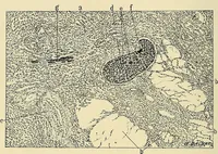 An illustration from Cancer of the uterus : its pathology, symptomatology, diagnosis, and treatment : also the pathology of diseases of the endometrium / by Thomas Stephen Cullen ; with eleven lithographic plates and over three hundred coloured and black illustrations in the text by May Brödel and Hermann Becker. (1900)