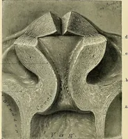 An illustration from Cancer of the uterus : its pathology, symptomatology, diagnosis, and treatment : also the pathology of diseases of the endometrium / by Thomas Stephen Cullen ; with eleven lithographic plates and over three hundred coloured and black illustrations in the text by May Brödel and Hermann Becker. (1900)