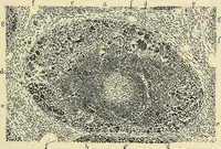 An illustration from Cancer of the uterus : its pathology, symptomatology, diagnosis, and treatment : also the pathology of diseases of the endometrium / by Thomas Stephen Cullen ; with eleven lithographic plates and over three hundred coloured and black illustrations in the text by May Brödel and Hermann Becker. (1900)