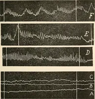 An illustration from Des Indes la plane Mars : ude sur un cas de somnambulisme avec glossolalie / par Th. Flournoy. (1900)