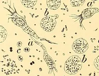 An illustration from Clinical diagnosis : the bacteriological, chemical, and microscopical evidence of disease / by Rudolf v. Jaksch ; tr. from the 3rd German ed. and enlarged by James Cagney ; with numerous illustrations (partly in colours). (1893)