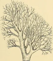 An illustration from Clinical diagnosis : the bacteriological, chemical, and microscopical evidence of disease / by Rudolf v. Jaksch ; tr. from the 3rd German ed. and enlarged by James Cagney ; with numerous illustrations (partly in colours). (1893)