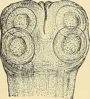 An illustration from Clinical diagnosis : the bacteriological, chemical, and microscopical evidence of disease / by Rudolf v. Jaksch ; tr. from the 3rd German ed. and enlarged by James Cagney ; with numerous illustrations (partly in colours). (1893)