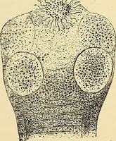 An illustration from Clinical diagnosis : the bacteriological, chemical, and microscopical evidence of disease / by Rudolf v. Jaksch ; tr. from the 3rd German ed. and enlarged by James Cagney ; with numerous illustrations (partly in colours). (1893)